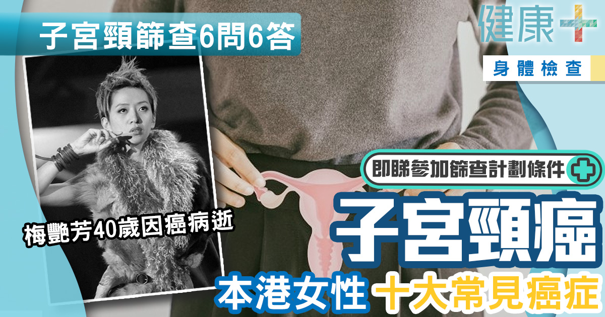 婦女健康|本港女性十大常見癌症:子宮頸癌 定期做子宮頸篩查預防病發 健康-疾病資訊-身體檢查-癌症篩查-子宮頸癌