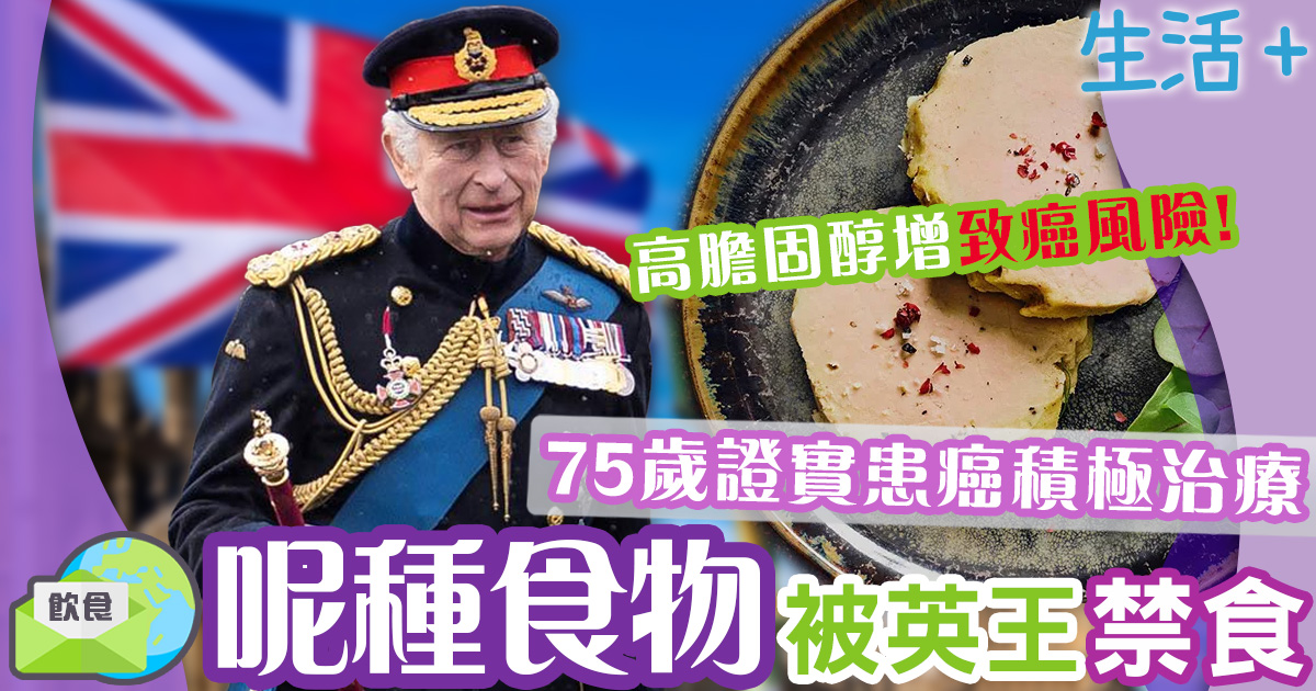 英王查理斯三世禁皇室食鵝肝 呢幾類人食肥肝最危險 生活-健康-飲食-英王-脂肪肝-膽固醇