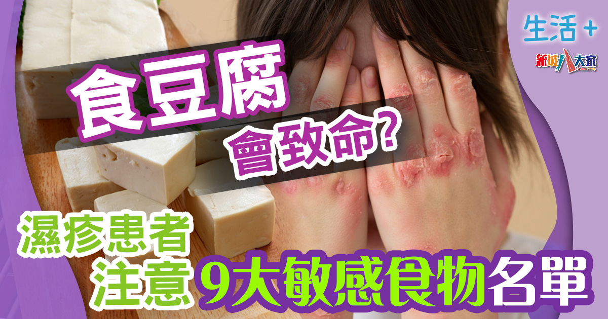 生活-飲食-健康-食物敏感-清單