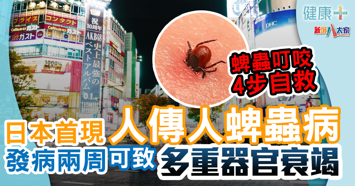 健康-疾病資訊-遊日注意-蜱蟲傳染病-SFTS