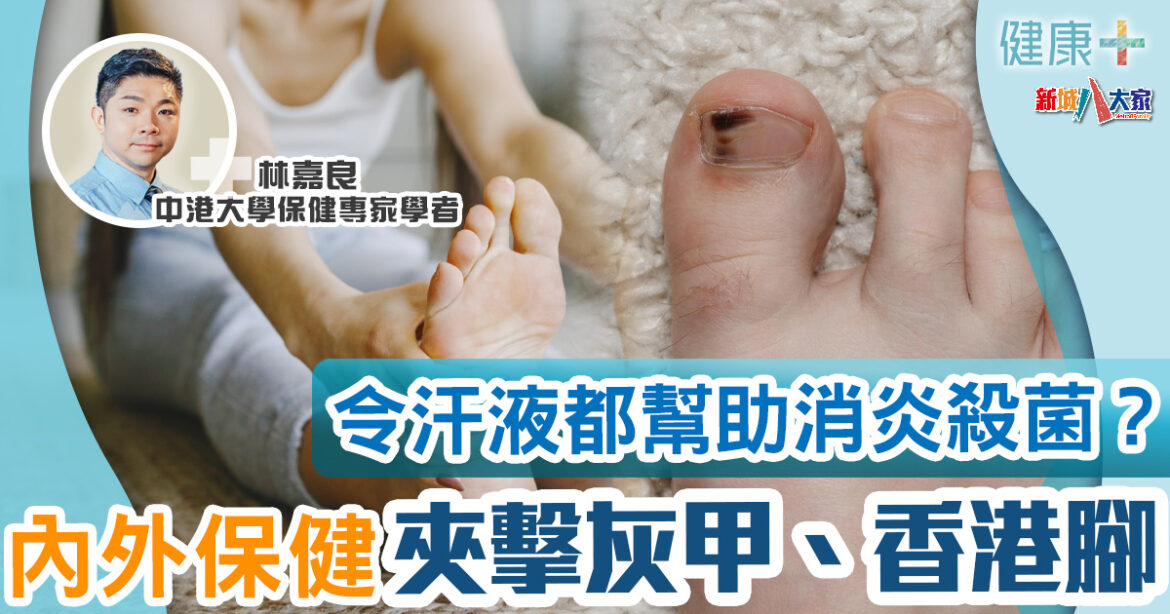 保健專家｜內外保健夾擊灰甲、香港腳　令汗液都幫助消炎殺菌？