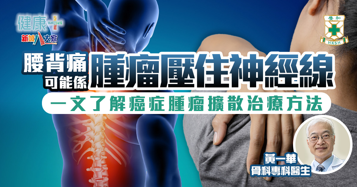 腰背痛可能係腫瘤壓住神經線?治療癌症腫瘤擴散唔止靠開刀|養和醫院骨科專科醫生黃一華 健康-養和抗病兵工廠-癌症-腫瘤-脊椎轉移性腫