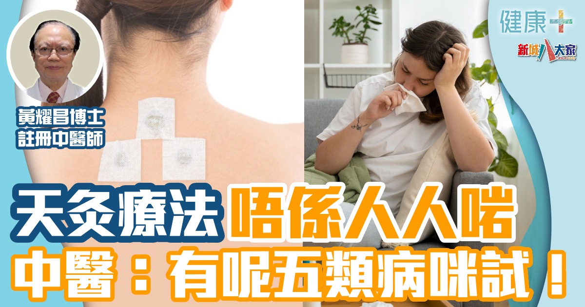 天灸療法唔係人人啱 中醫:有呢五類病咪試! 健康-時令養生-天灸