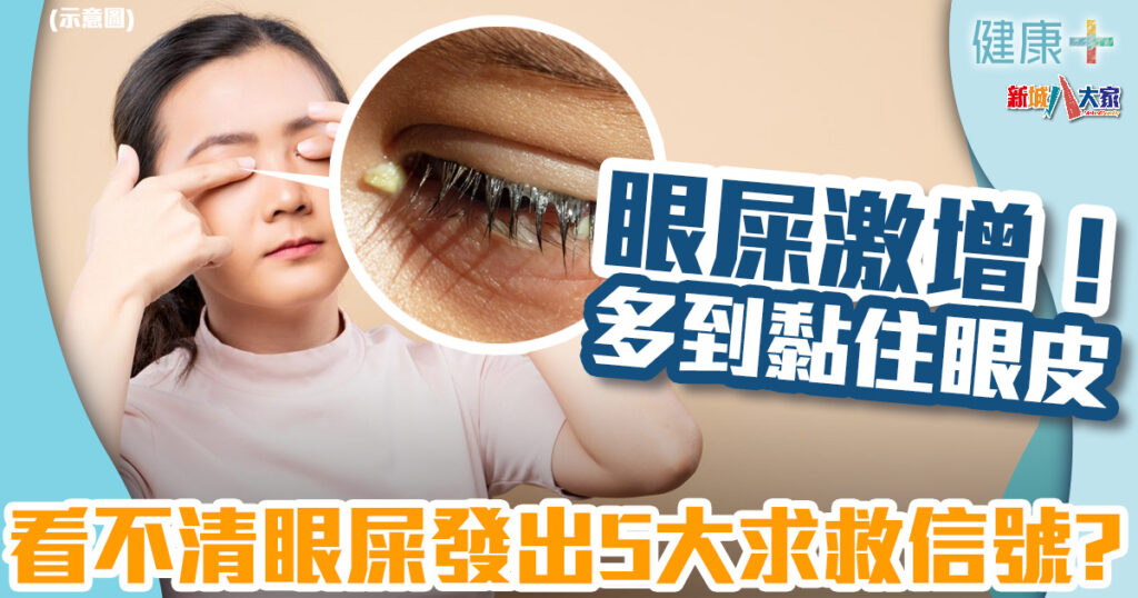 眼屎激增!多到把眼睛黏住 看不清眼屎發出5大求救信號?