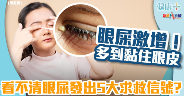 健康-疾病資訊-眼睛健康-眼屎-眼垢