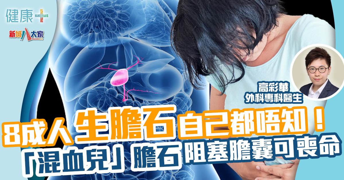 8成人生膽石自己都唔知!「混血兒」膽石阻塞膽囊可喪命 健康-疾病資訊-膽結石-膽石