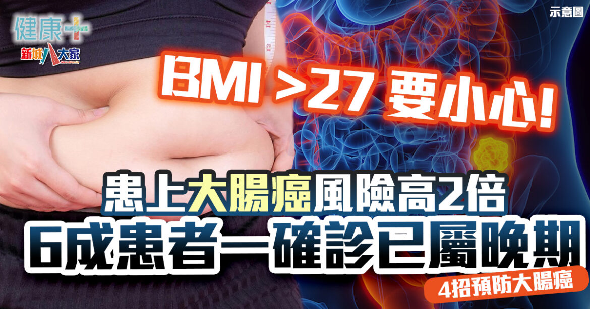 疾病資訊｜BMI超過27 患大腸癌風險增兩倍！ 60％患者確診時已屬晚期