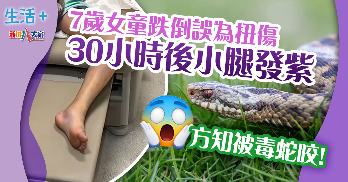 7歲女童跌倒誤為扭傷 30小時後小腿發紫!方知被毒蛇咬 生活-戶外活動-小腿發紫-蛇咬-中毒