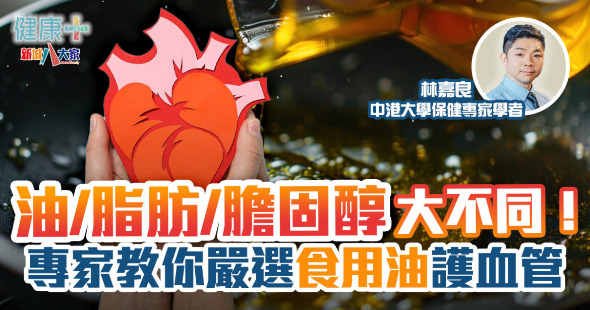 保健專家｜油/脂肪/膽固醇大不同！專家教你嚴選食用油護血管