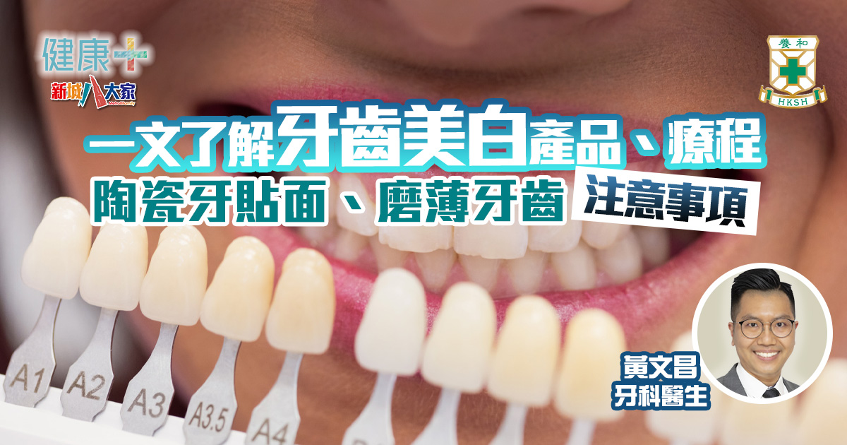 一文了解牙齒美白產品、療程 陶瓷牙貼面、磨薄牙齒注意事項|牙科醫生黃文昌 20250220temp-HKSH_V2