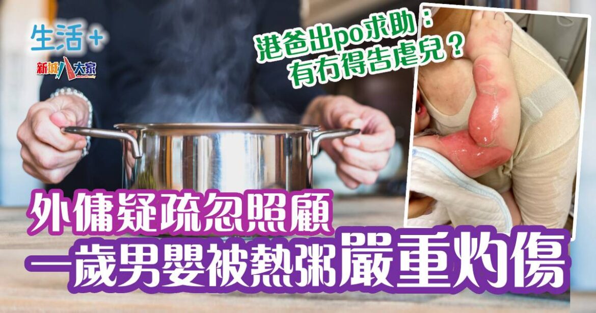 外傭疑疏忽照顧 BB被熱粥嚴重灼傷 港爸求助：有冇得告虐兒？（附燙傷處理）