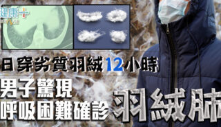 日穿劣質羽絨12小時 男子驚現呼吸困難確診「羽絨肺」 羽絨肺