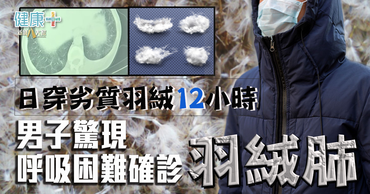 羽絨肺