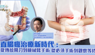 直腸癌治療新時代:從傳統開刀到機械臂手術 從必須手術到觀察等待 直腸癌手術