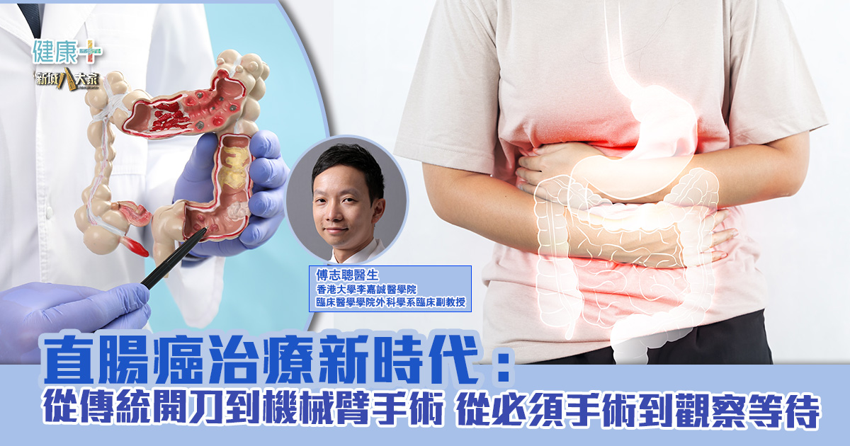 直腸癌治療新時代:從傳統開刀到機械臂手術 從必須手術到觀察等待 直腸癌手術