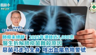 肺癆未絕跡 2025年港錄近3,000宗 醫生拆解肺癆菌難殺原因 惡菌可走勻全身 咳出血屬危險警號|養和醫院呼吸系統科中心主任林冰醫生 a50