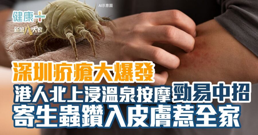 20260720_Scabies