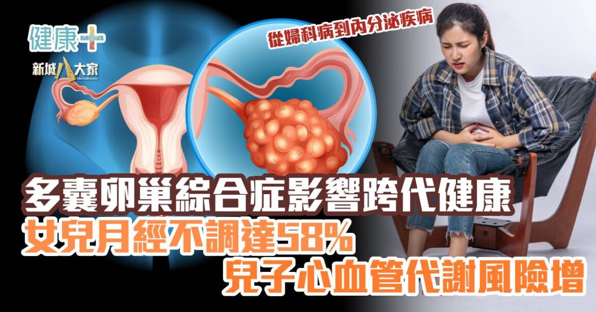 多囊卵巢綜合症影響跨代健康 女兒月經不調達58% 兒子心血管代謝風險增