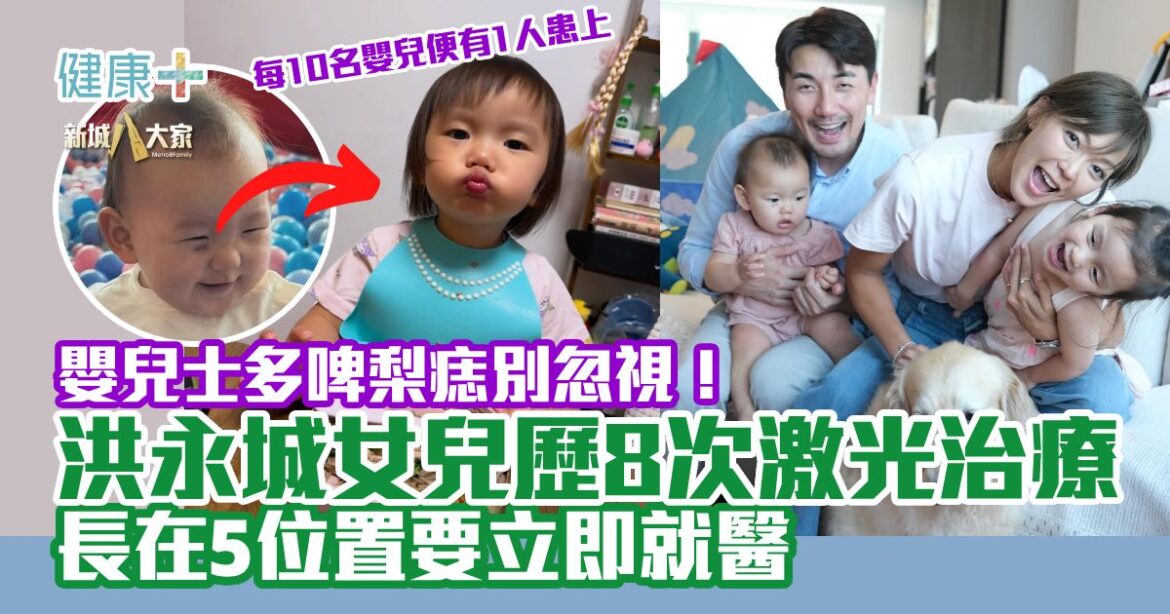 嬰兒士多啤梨痣別忽視！洪永城女兒歷8次激光治療 長在5位置要立即就醫